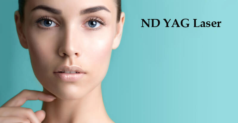 nd yag laser machine