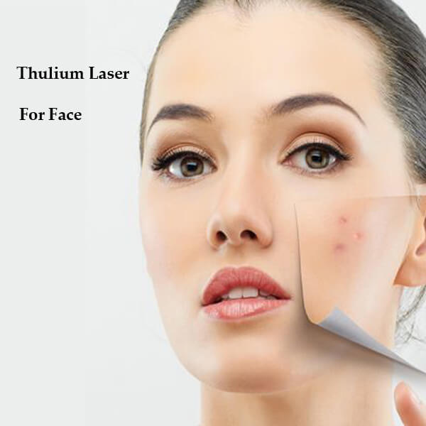 thulium fiber laser