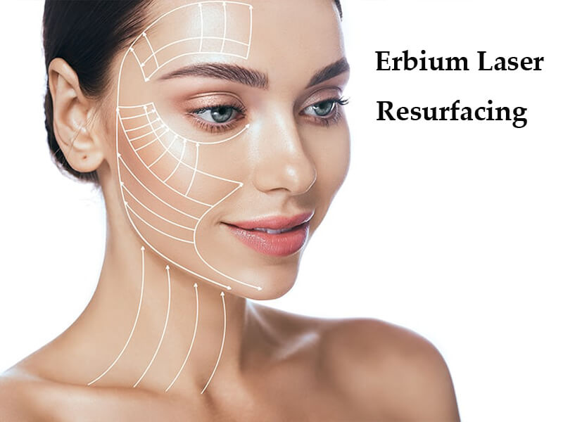 erbium laser machine